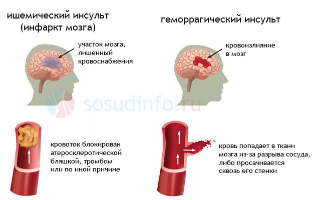 купить кроссовую резину на мотоцикл 18 радиус
